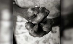 Squirrels, Armadillos and Now Apes Have Leprosy | Ancient Origins